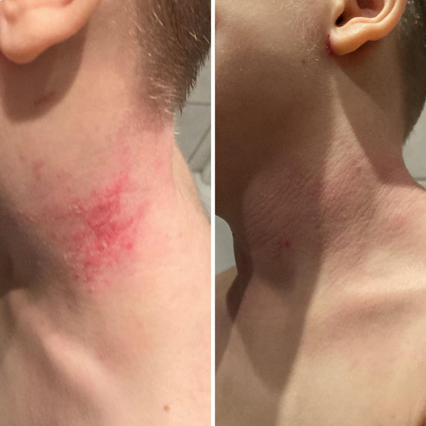 Salzdusche Starterset von shower+